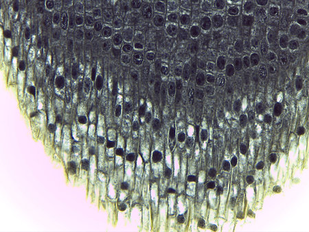 Microscopic View of Metaphase and Interphase Cells in Plant Tissue