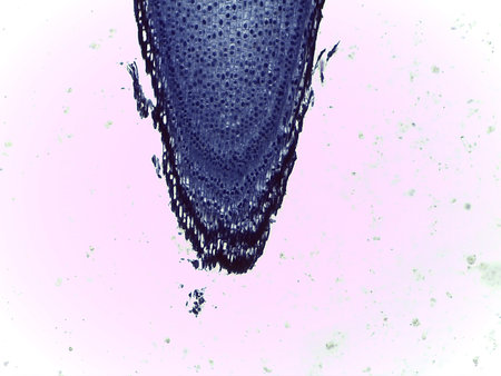 Microscopic View of Anaphase/Mitosis in Plant Tissue Cellsの写真素材