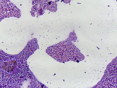 Microscopic Field of Purple Bacilli Showing Chains and Clumps