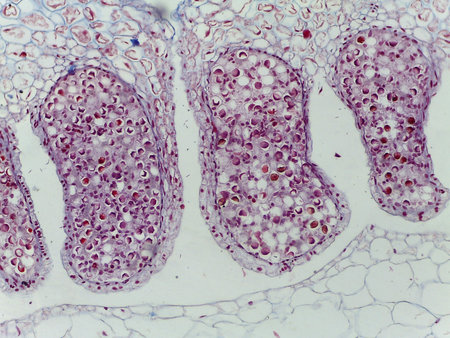 Microscopic Cross-Section of Equisetum (Horsetail) Sporangia within the Strobilus
