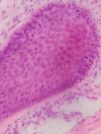 Microscopic view of tissue with pink and purple staining, showing cellular structures and patternsの写真素材