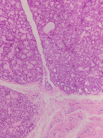 Microscopic view of tissue with purple staining, showing cellular structures and connective tissue