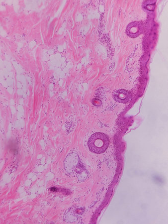 Microscopic view of skin tissue showing layers with pink and purple staining, highlighting cellular structures and fibersの写真素材