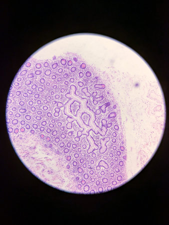 Pancreas in Lab with Gram-negative rod-shaped bacteria.