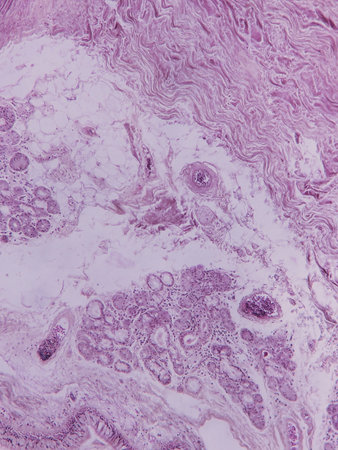Microscopic view of tissue sample showing various cell structures and patterns in shades of pink and...