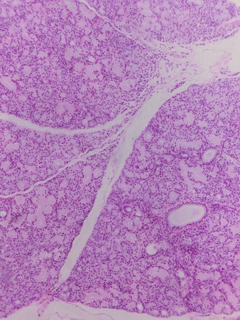 Microscopic view of tissue with pink and purple staining, showing cellular structures and patternsの写真素材