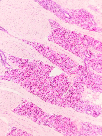 Microscopic view of muscle tissue stained with hematoxylin and eosin, showing pink and purple hues,...