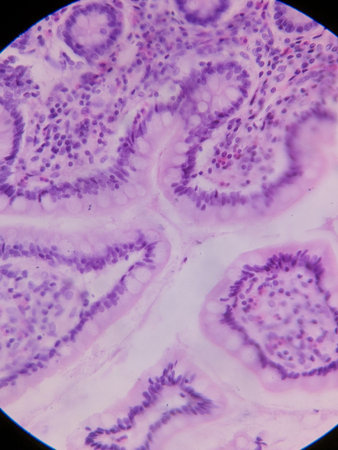 Microscopic view of tissue with purple staining, showing cellular structures and glandular...