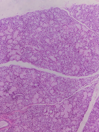 A microscopic view of tissue with a pink and purple staining pattern, showcasing cellular structures...