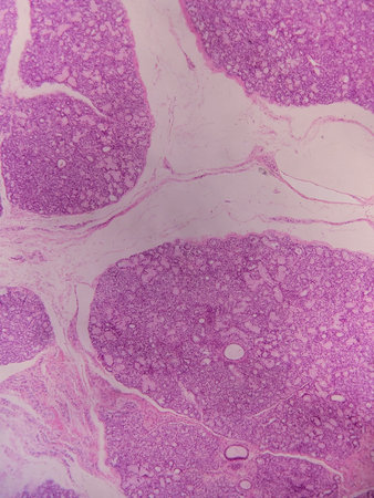 Histopathology of human liver under microscope view for medical education.