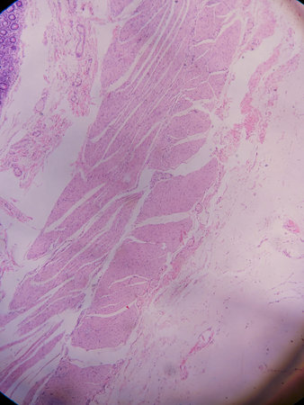 Microscopic view of muscle tissue showing striations and fibers