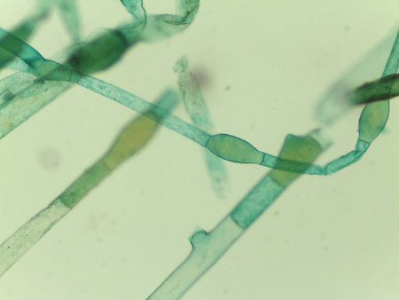 Microscopic View of the Filamentous Green Algae, Pithophora, Showing Akinetesの写真素材