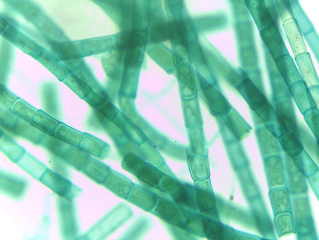 Microscopic View of Filamentous Algae (Oedogonium) with Potential Dwarf Male Filaments