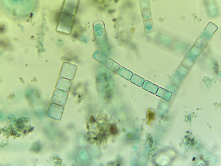 Microscopic View of the Filamentous Diatom Melosira Showing Auxospore Formation.