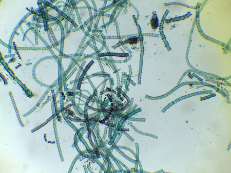Microscopic View of the Filamentous Green Algae, Ulothrix