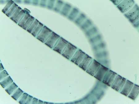 Microscopic View of the Filamentous Green Algae, Ulothrix