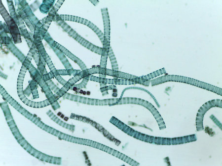 Microscopic View of the Filamentous Green Algae, Ulothrix