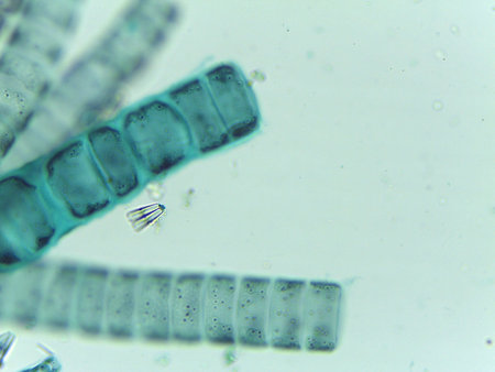 Microscopic View of the Filamentous Green Algae, Ulothrix