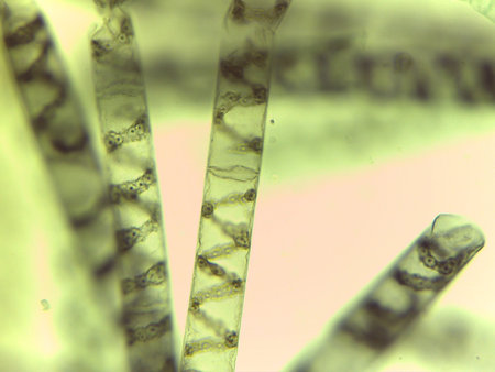 Microscopic View of the Filamentous Green Algae, Spirogyra, Highlighting Spiral Chloroplasts