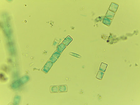 Microscopic View of the Filamentous Diatom Melosira Showing Auxospore Formation.