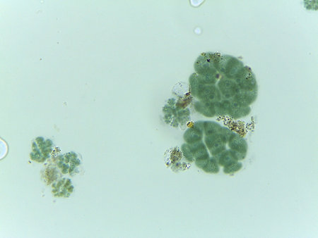Microscopic View of the Colonial Green Alga, Pandorina