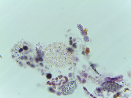 Microscopic View of a Colonial Green Alga, Pediastrum, Amidst Debri