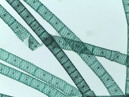 Microscopic View of Multiple Spirogyra Filaments Showing Segmented Cells and Spiral Chloroplastsの写真素材