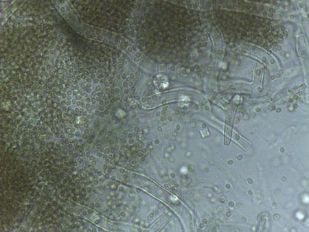 Microscopic field of Aspergillus conidiophores, releasing abundant spores into the medium.