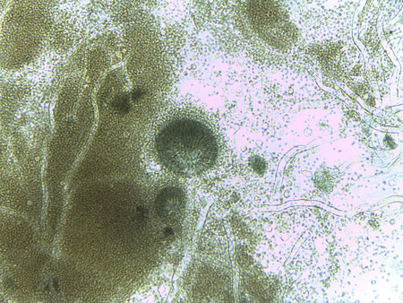 Microscopic field of Aspergillus conidiophores, releasing abundant spores into the medium.