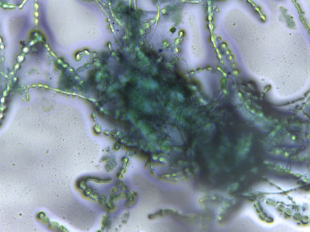 Micrograph showing intertwined septate and dematiaceous fungal hyphae in a dense network.
