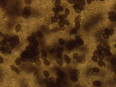 Fungal reproduction: Abundant oval spores aggregated within a pigmented sporulating matrix.