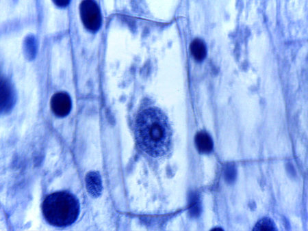 Micrograph of Anaphase, showing sister chromatids pulled to opposite poles in a plant cell