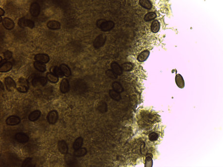 Fungal reproduction: Abundant oval spores aggregated within a pigmented sporulating matrix.の写真素材