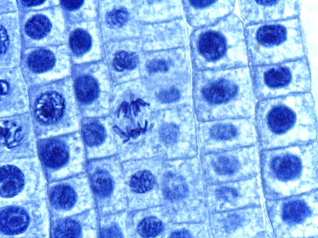 Micrograph of Anaphase, showing sister chromatids pulled to opposite poles in a plant cell