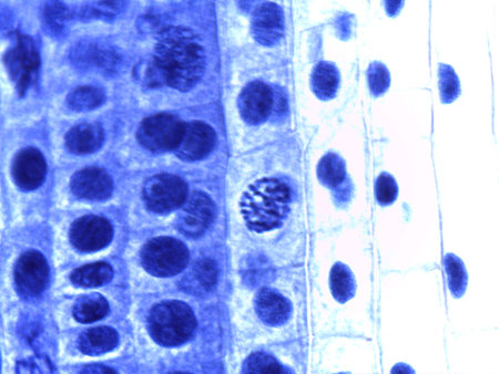 Micrograph of Anaphase, showing sister chromatids pulled to opposite poles in a plant cell