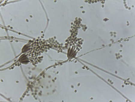 Microscopic view of the brush-like conidiophore and oval spores of Penicillium mold.
