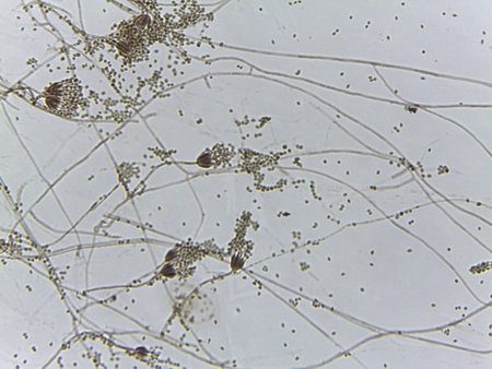 Microscopic view of the brush-like conidiophore and oval spores of Penicillium mold.