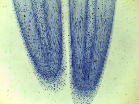Micrograph of Anaphase, showing sister chromatids pulled to opposite poles in a plant cellの写真素材