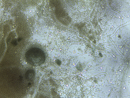 Microscopic field of Aspergillus conidiophores, releasing abundant spores into the medium.
