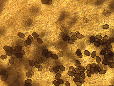 Fungal reproduction: Abundant oval spores aggregated within a pigmented sporulating matrix.