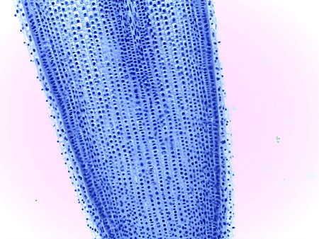 Micrograph of Anaphase, showing sister chromatids pulled to opposite poles in a plant cell