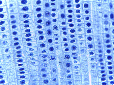 Micrograph of Anaphase, showing sister chromatids pulled to opposite poles in a plant cell