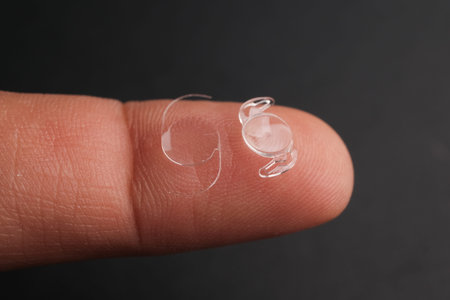 Microscopic View of a Clear, Biocompatible Acrylic Phaco-Foldable Intraocular Lens (IOL) Ready for...
