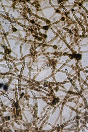 Microscopic View of Septate Dematiaceous Fungal Hyphae and Possible Chlamydospores