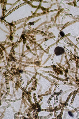Microscopic View of Septate Dematiaceous Fungal Hyphae and Possible Chlamydospores