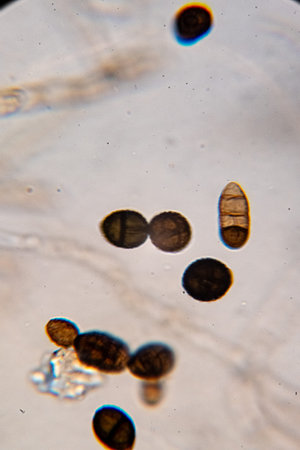 Dematiaceous Fungal Spores Exhibiting Transverse and Longitudinal Septation, Likely of the Genus...
