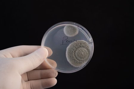 Massive Growth of Identified Penicillium Species Fungal Colony in a Microbiology Laboratory Petri...