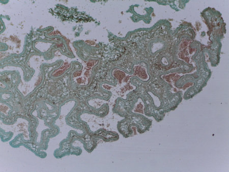 Microscopic Examination of Claviceps Purpurea Conidia and Fungal Reproductive Structuresの写真素材