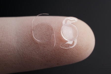 The Flexible Foldable Intraocular Lens (IOL): A Biocompatible Acrylic Implant Used in Minimally Invasive Phacoemulsification Cataract Surgeryの写真素材