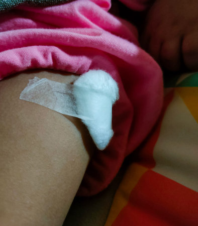 Closeup of white cotton plastered on a baby's thigh after being poked in a health clinic.
